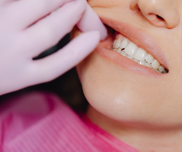 子どもの歯科検診