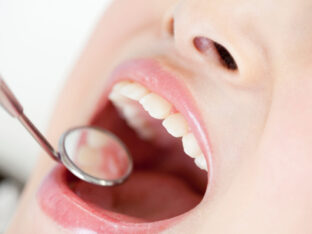 定期的な通院で歯並びをチェック